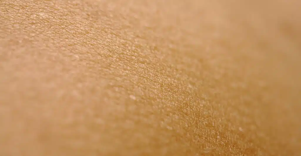 A very close-up, textured view of human skin with visible pores and slight unevenness.